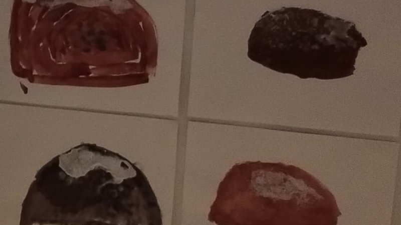 Stajun od lumblije u vrtiću